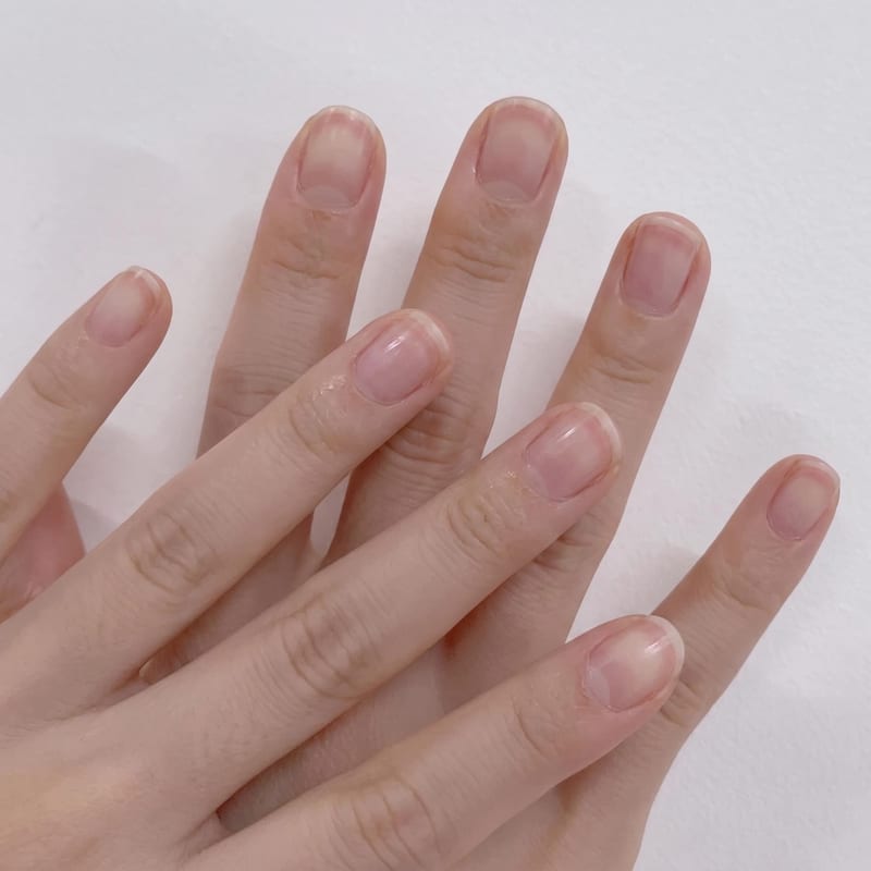 Hand Image